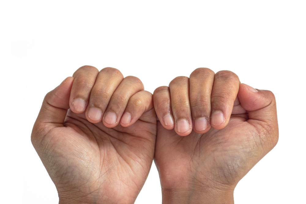 Ce que la couleur et l'aspect des ongles disent de la santé du corps