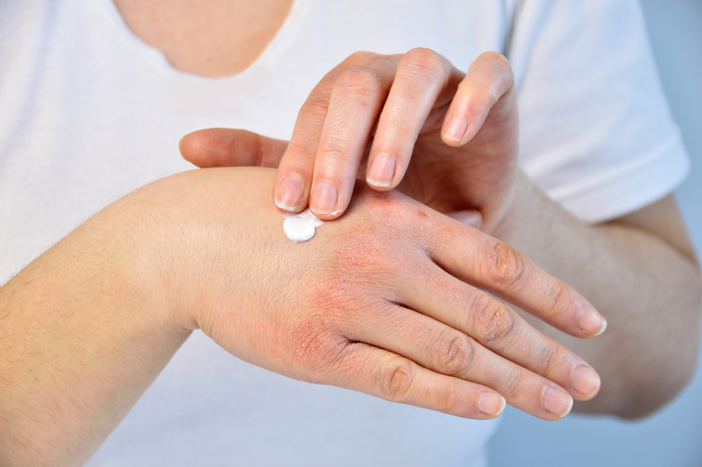 Pourquoi ai-je la peau des mains sèche et comment l'éviter